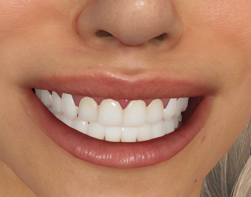 ccTeeth Character Creator 4 CC4 White Teeth